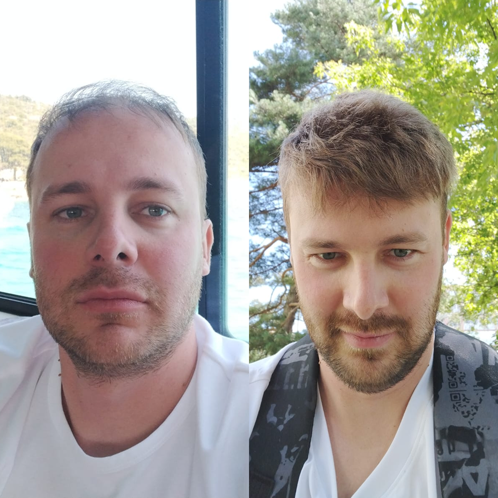 Men’s Toupee Transparent Poly Skin Hair 0.08 mm